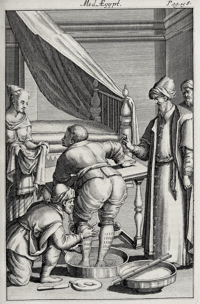 Bloodletting Illustration circa 1745 from Rosperi Alpini